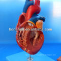 ISO Advanced Anatomical Heart, Medical Heart, человеческое сердце